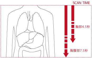 日立独自の3次元画像再構成アルゴリズムCORE法